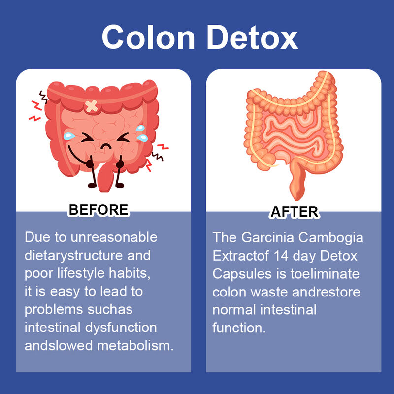 Private label 14 Day Slim Capsule ondersteunt spijsverteringsgezondheid en gewichtsverlies Voedingssupplement Detox capsules